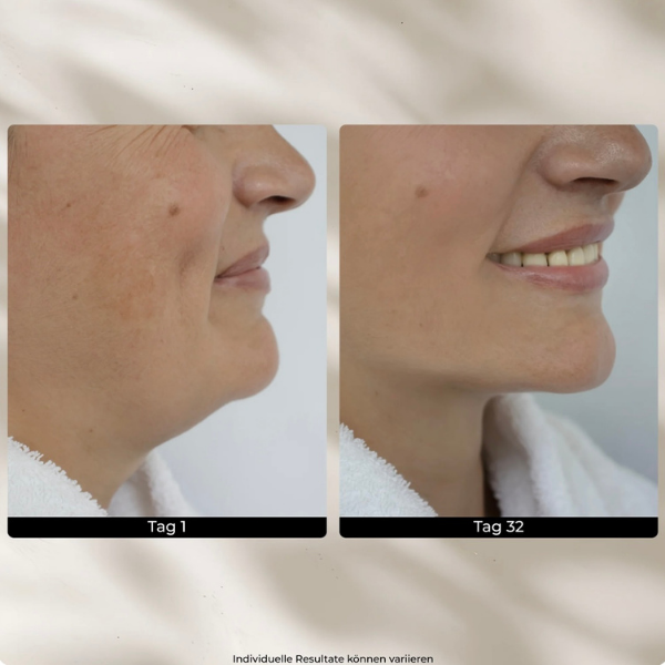 GlowLift EMS Pro – Premium Beautygerät mit Lichttherapie