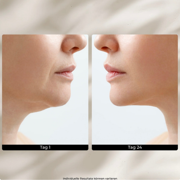 GlowLift EMS Pro – Premium Beautygerät mit Lichttherapie